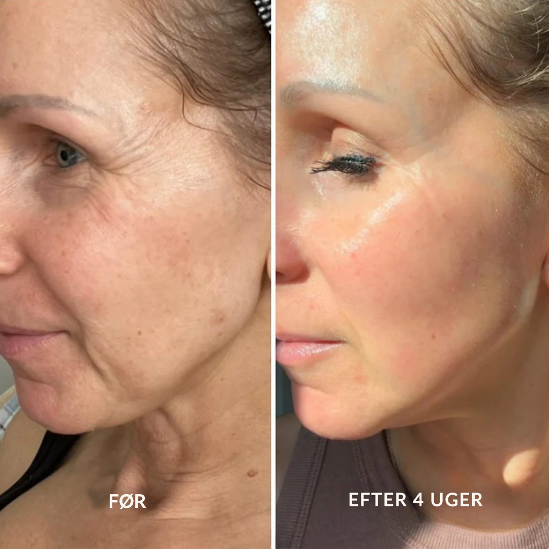 Retinal A-Shot ™ – Den blide koreanske hudfornyelse