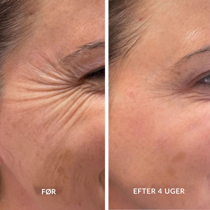 Retinal A-Shot ™ – Den blide koreanske hudfornyelse