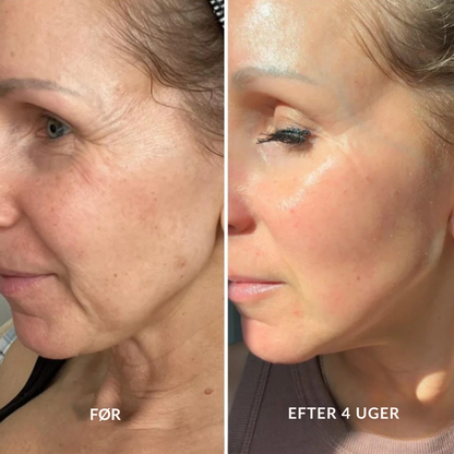 Retinal A-Shot ™ – Den blide koreanske hudfornyelse